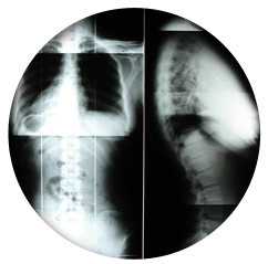 Chiropractic Grand Rapids MI X-Ray