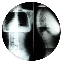 Chiropractic Grand Rapids MI X-Ray